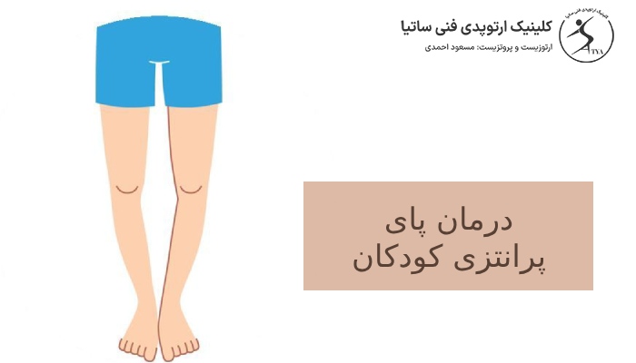 درمان پای پرانتزی کودکان چیست