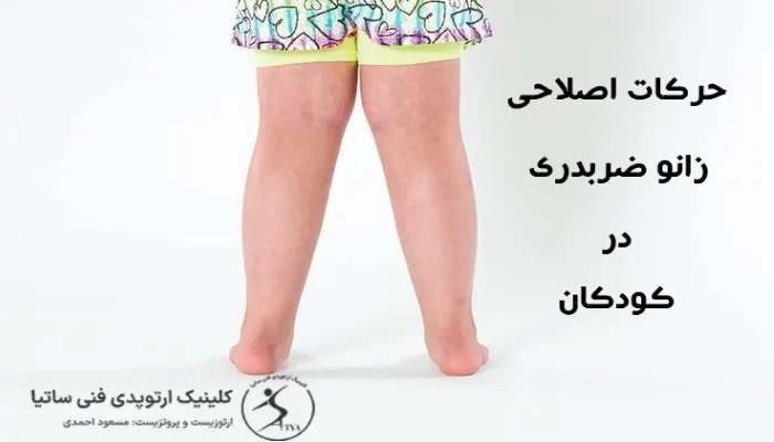 اهمیت حرکات اصلاحی زانو ضربدری کودکان