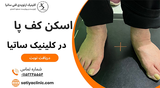 اسکن کف پا چیست