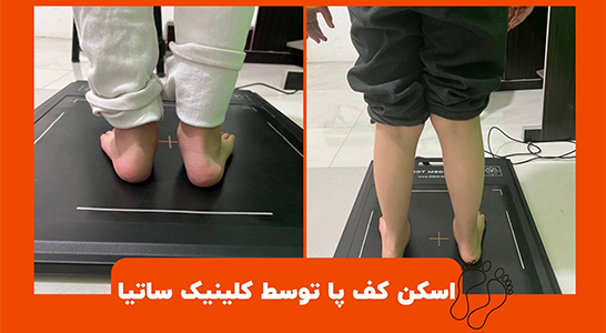 انواع اسکن کف پا