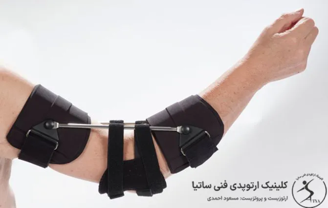 طراحی و ساخت انواع بریس طبی