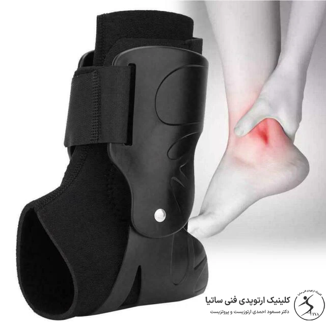 بریس و ارتز مچ پا