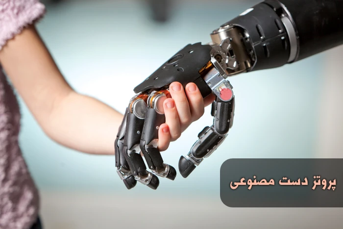 پروتز دست مصنوعی