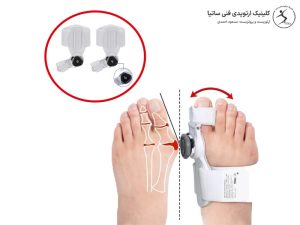 اسپلینت هالوکس والگوس