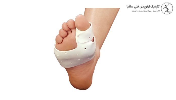 انواع اسپلینت هالوکس والگوس