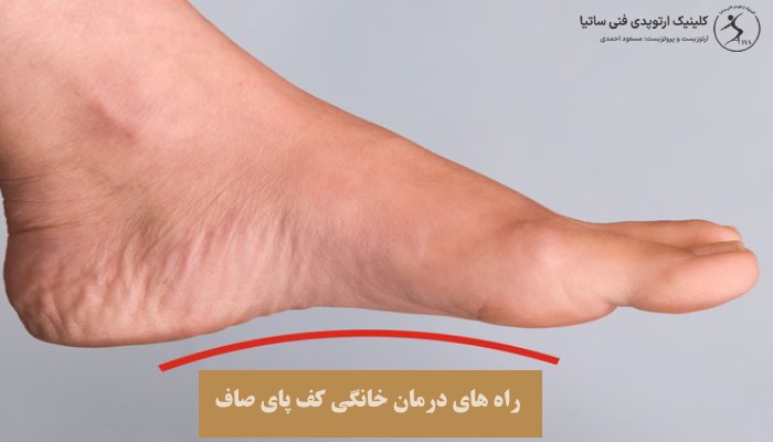 راه های درمان خانگی کف پای صاف
