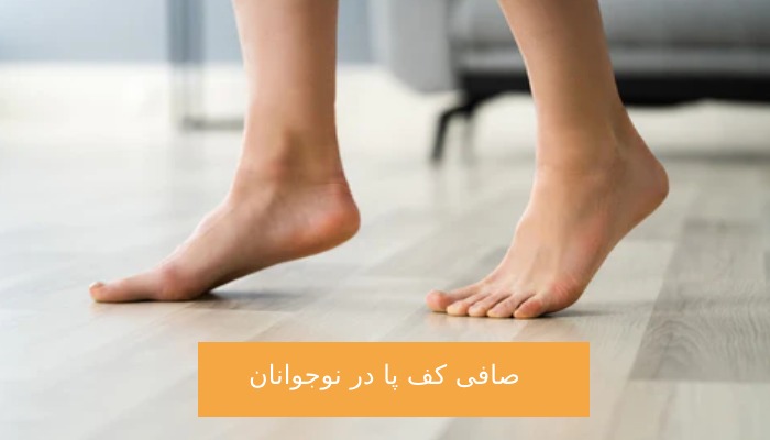 صافی کف پا در نوجوانان چیست؟
