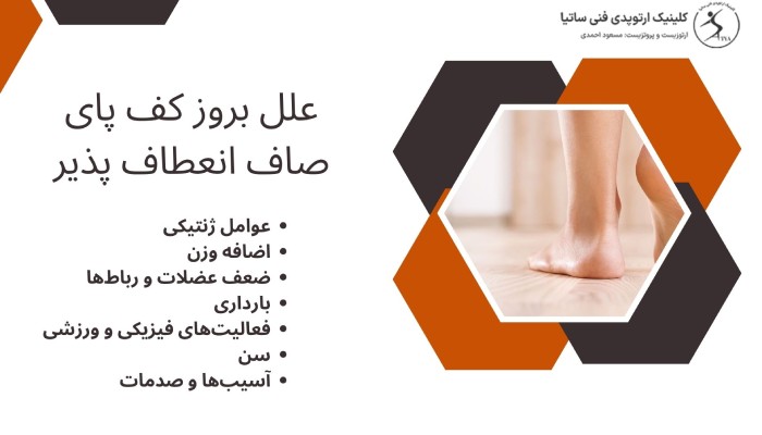 علل کف پای صاف انعطاف پذیر