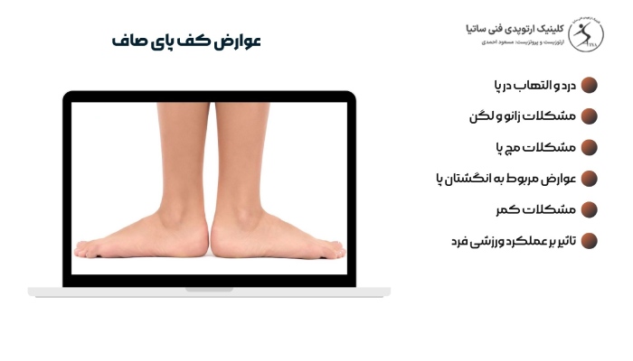 عوارض کف پای صاف چیست؟