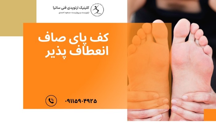 کف پای صاف انعطاف پذیر چیست؟