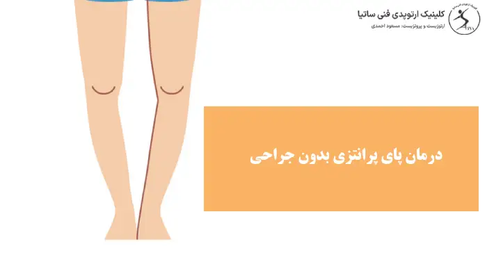 اثر درمان پای پرانتزی بدون جراحی