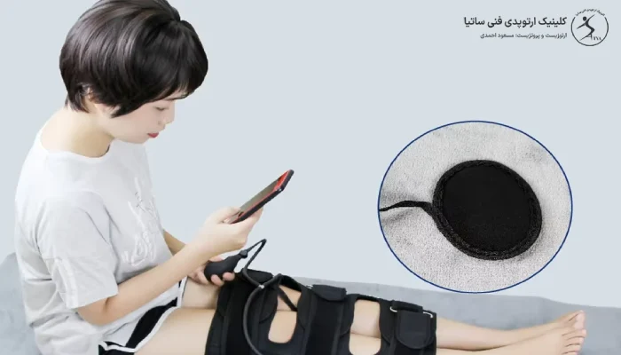 انواع بریس پای پرانتزی