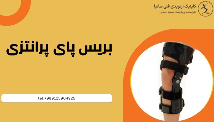 بریس پای پرانتزی چیست؟