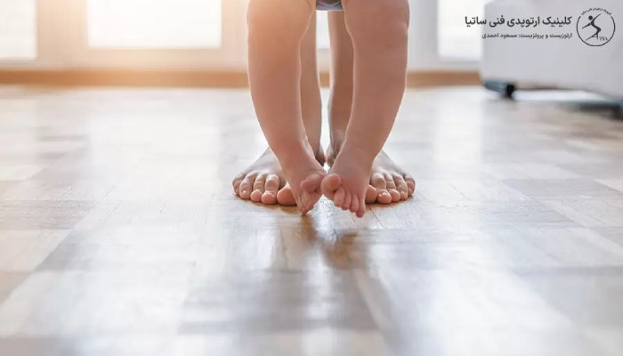 تعیین بهترین سن برای درمان پای پرانتزی