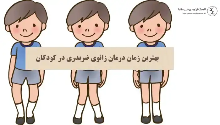 بهترین زمان زانوی ضربدری در کودکان
