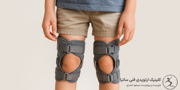 مراقبت از بریس زانو ضربدری