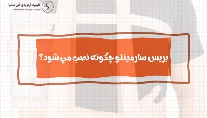 نصب بریس سارمینتو