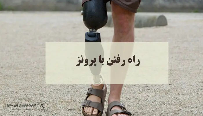 توانایی راه رفتن با پروتز