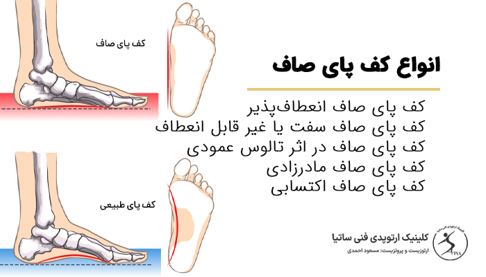لیست انواع مختلف کف پای صاف