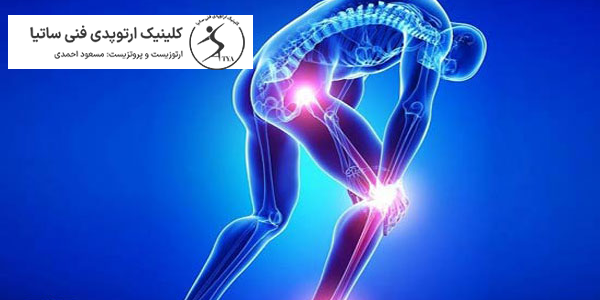 تفاوت دیسک کمر و سیاتیک