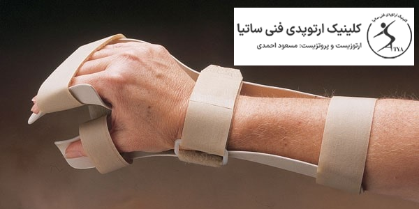 ارتز دست