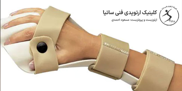 ارتز دست