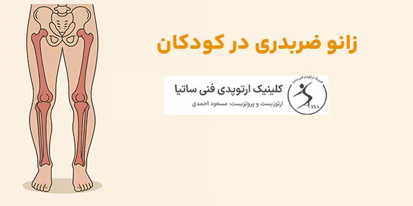 علائم زانو ضبدری
