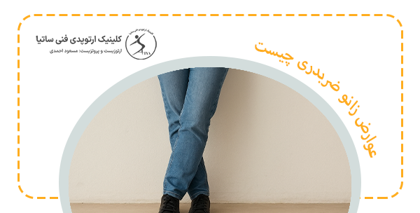عوارض زانو ضربدری چیست