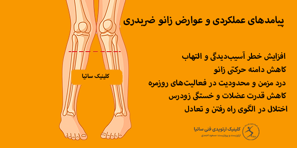 پیامد های زانو ضربدری