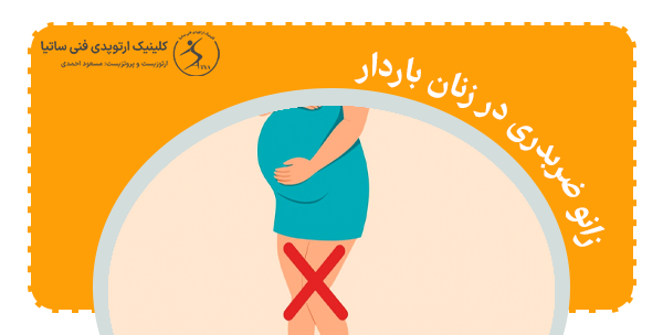 زانو ضربدری در زنان بارداری و عوارض آن